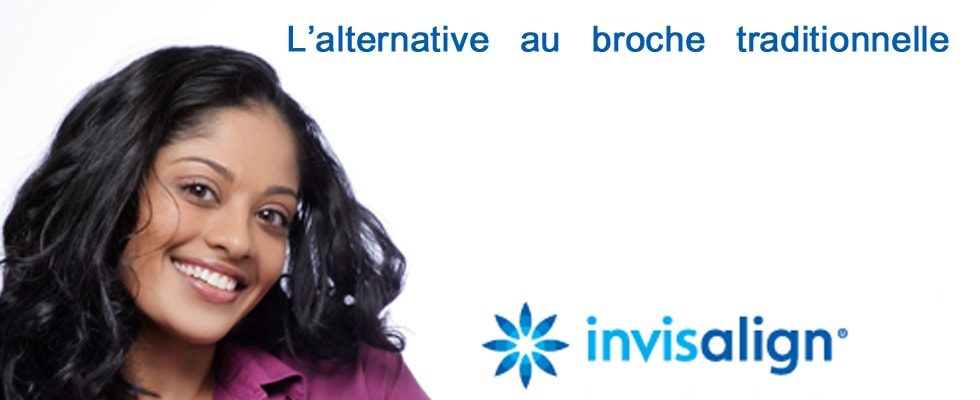 Orthodontic and invisalign